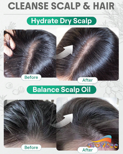 SHEGLAM HAIR Rosemary Hair And Scalp Oil -15ml