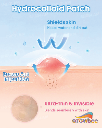 SHEGLAM Anytime Invisible Blemish Patches