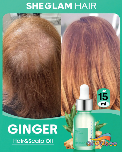 SHEGLAM HAIR Ginger Hair & Scalp Oil-15ml