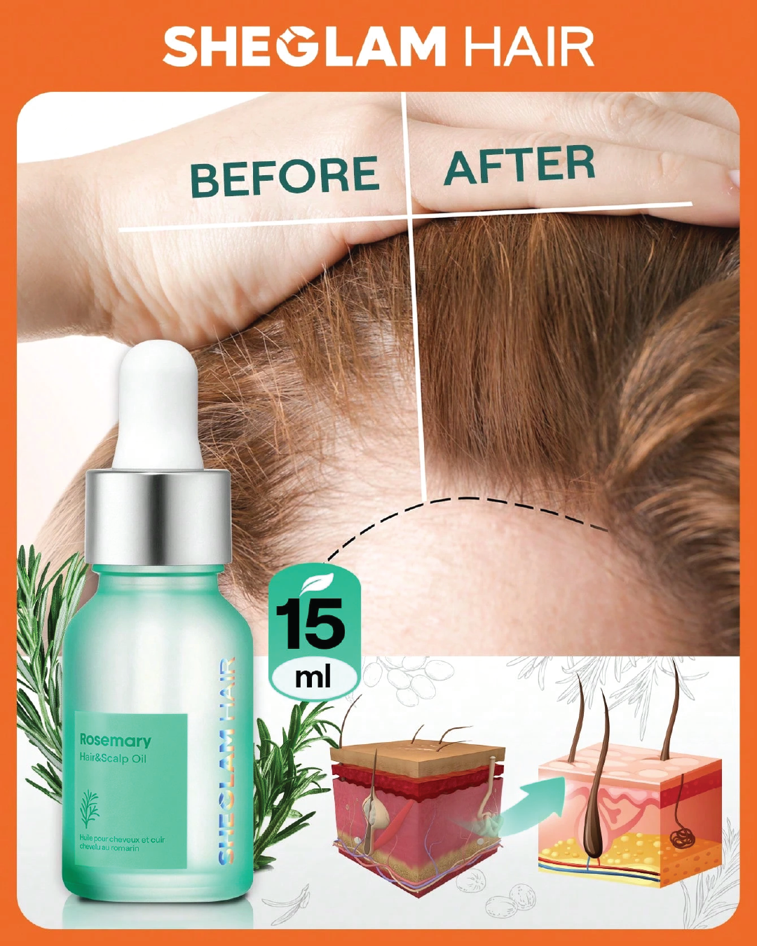SHEGLAM HAIR Rosemary Hair And Scalp Oil -15ml